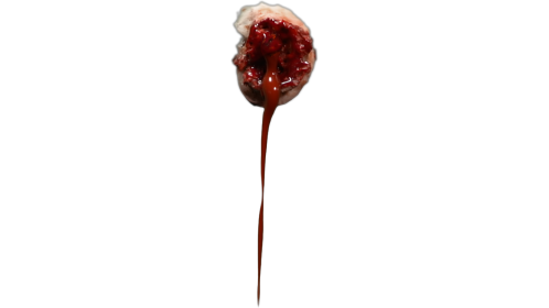 Bleeding Wound  1  Gunshot