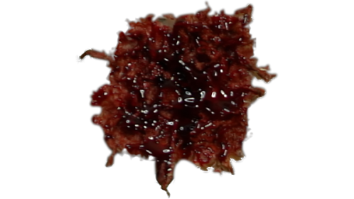 Bleeding Wound  7 Blunt Force