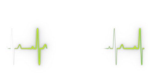 Heart Monitor Line 1