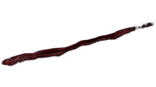 Wound Healing 4