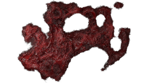 Wound Healing 8