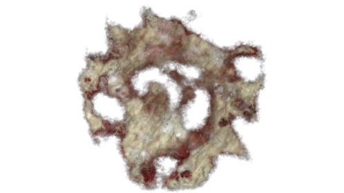 Zombie Wound 3