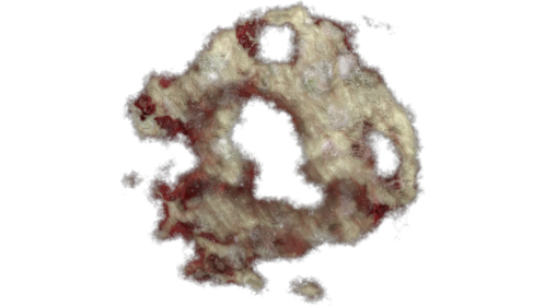 Zombie Wound 4