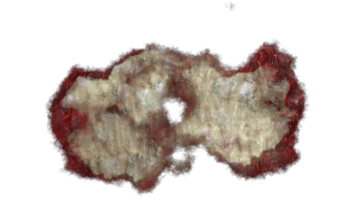 Zombie Wound 8
